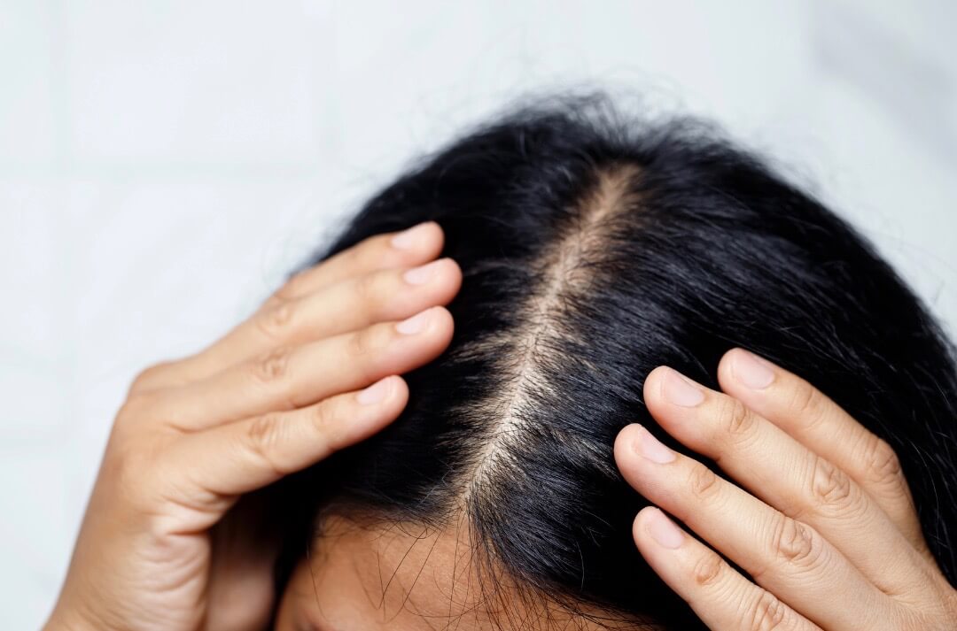 3 Scalp Care Tips for Healthier Hair How to Get a Healthier Scalp 3 Scalp Care Tips for Healthier Hair How to Get a Healthier Scalp