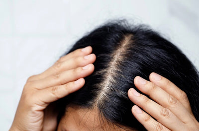 3 Scalp Care Tips You Need to Understand for Healthier Hair