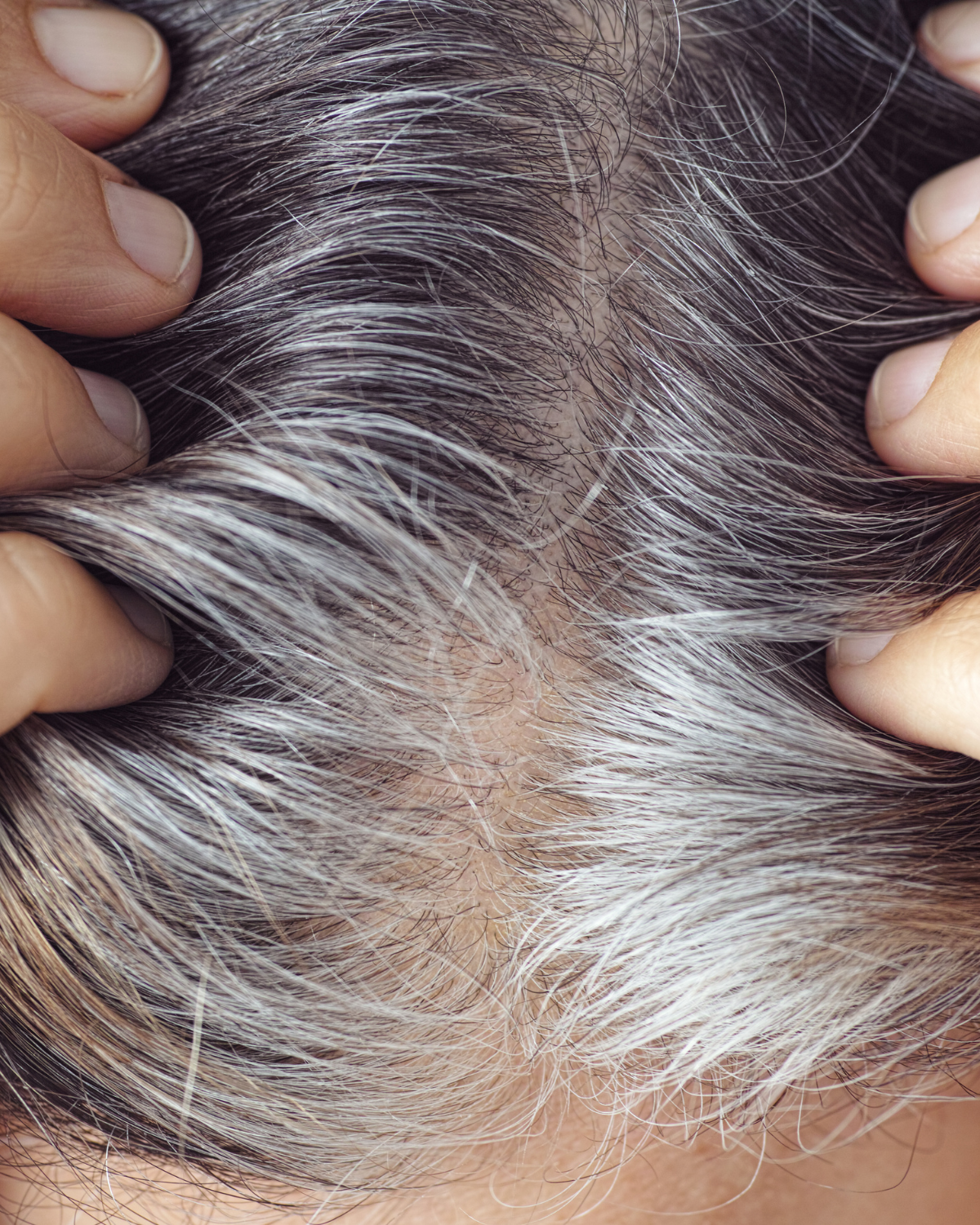 Scalp Ageing